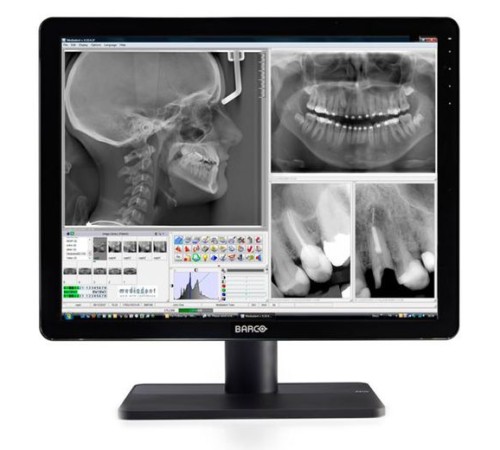 Barco Nio Color 3MP Dental